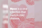 mpox in Pakistan, mpox break down, mpox emergency again, Kenya