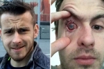contact lens wearers, is it bad to shower with contacts, contact lens wearers beware man goes blind after parasites eat man s eye as he wore lenses in shower, Eyesight