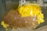 Scientists Develop 'Universal Kidney': Transplanted to any Blood Group