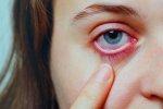 Conjunctivitis cases, Conjunctivitis prevention, special measures to prevent conjunctivitis, Pink eye