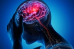 Canada Brain Disease, Canada Brain Disease symptoms, canada is hit by a mysterious brain disease, Urologist